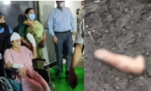 सहायक आयुक्तांवर फेरीवाल्याचा हल्ला, 3 बोटं तुटली