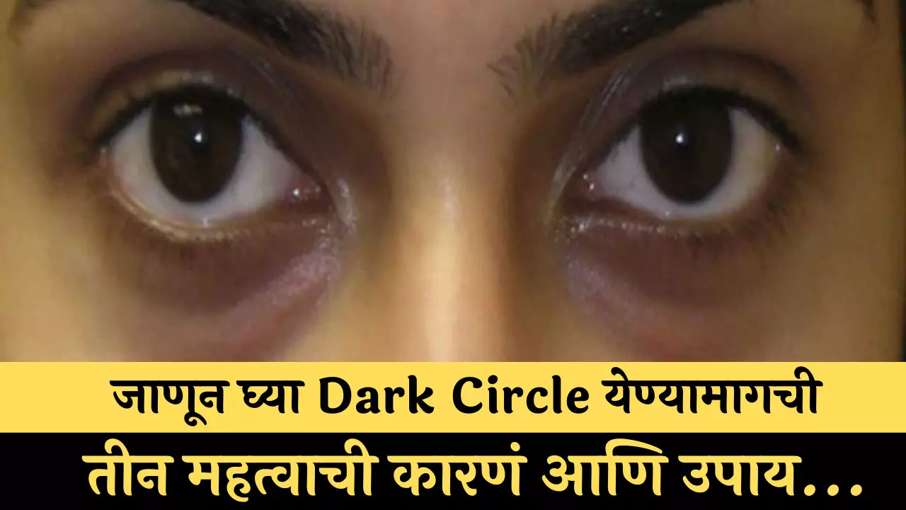 डोळ्यांखाली Dark Circle येत आहेत? जाणून घ्या Dark Circle येण्यामागची तीन महत्वाची कारणं आणि उपाय...