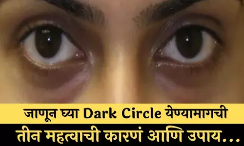 डोळ्यांखाली Dark Circle येत आहेत? जाणून घ्या Dark Circle येण्यामागची तीन महत्वाची कारणं आणि उपाय... डोळ्यांखाली Dark Circle येत आहेत? जाणून घ्या Dark Circle येण्यामागची तीन महत्वाची कारणं आणि उपाय...
