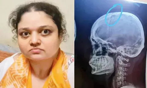 भयंंकर! कावळ्याला खाऊ घातलं म्हणून महिला डॉक्टरला झाली मारहाण भयंंकर! कावळ्याला खाऊ घातलं म्हणून महिला डॉक्टरला झाली मारहाण