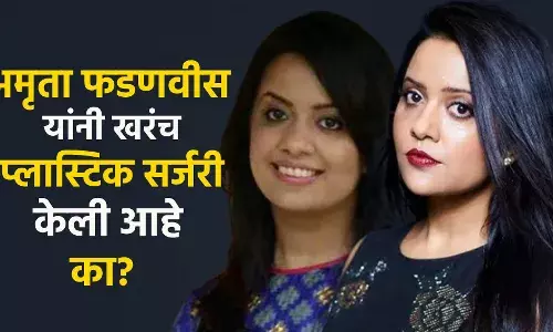 चेहऱ्याच्या प्लास्टिक सर्जरी बाबत अमृता फडणवीस यांचा खुलासा.. चेहऱ्याच्या प्लास्टिक सर्जरी बाबत अमृता फडणवीस यांचा खुलासा..