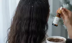 Dry Hair & Dandruff Care: थंडीतील केसांची निगा