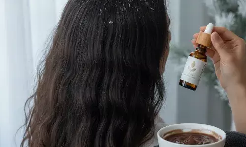 Dry Hair & Dandruff Care: थंडीतील केसांची निगा