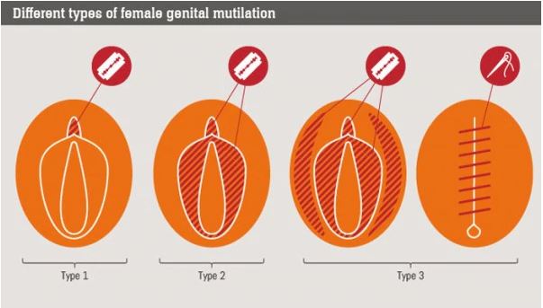 Female Genital Mutilation 